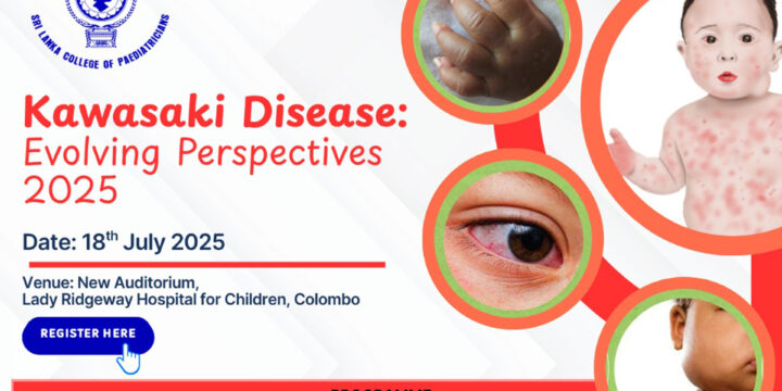 Kawasaki Disease: Evolving Perspectives 2025